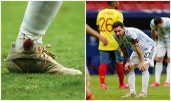 lionel messi feet