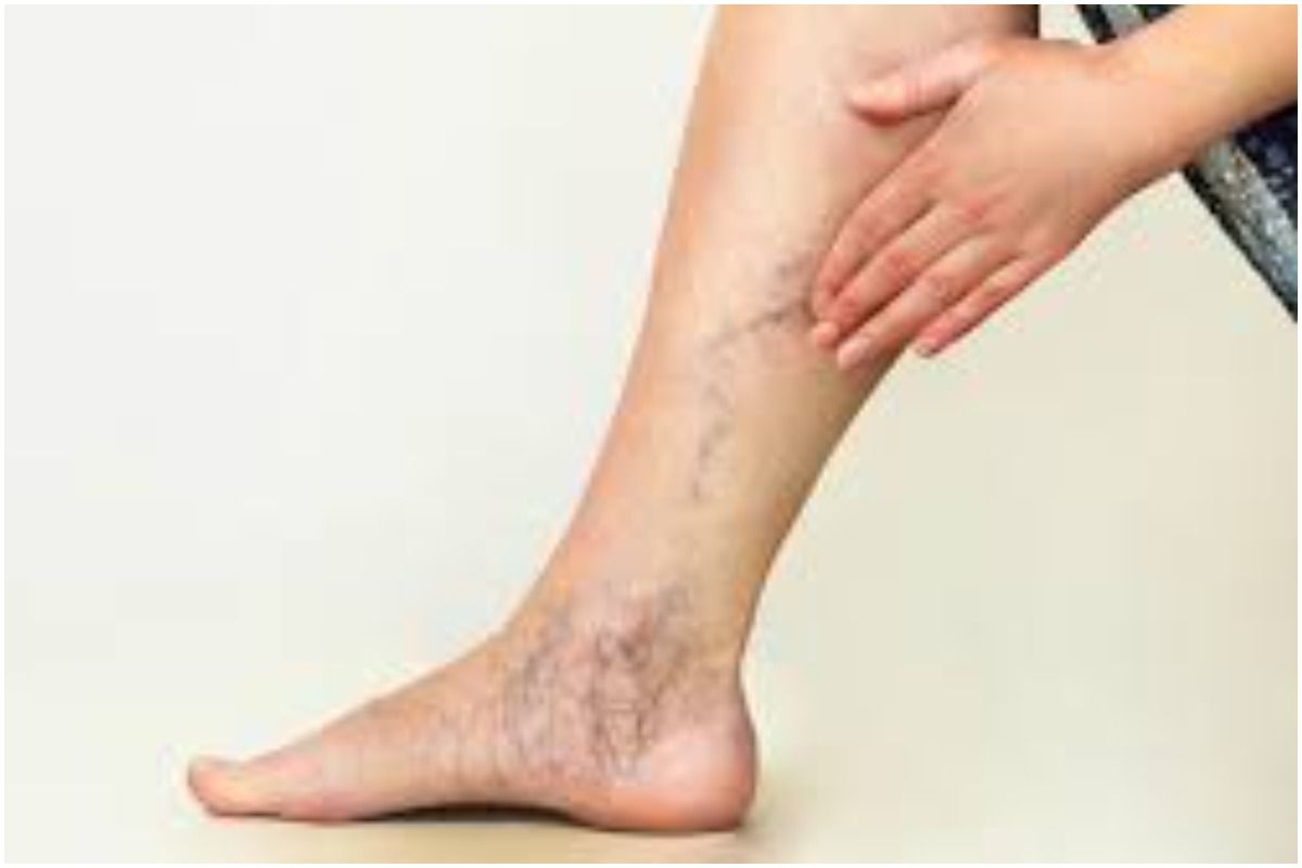 Veins Cramp Home Remedies रात में सोते समय चढ़ जाती है आपके पैर की नस