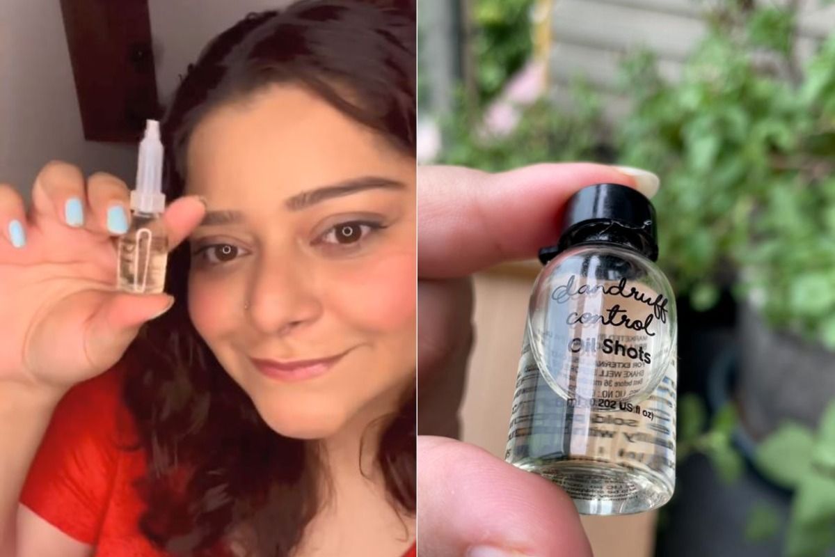 Irritated by Dandruff? Here’s How To Get Rid Of Flaky Scalp By Using Oil Shots
