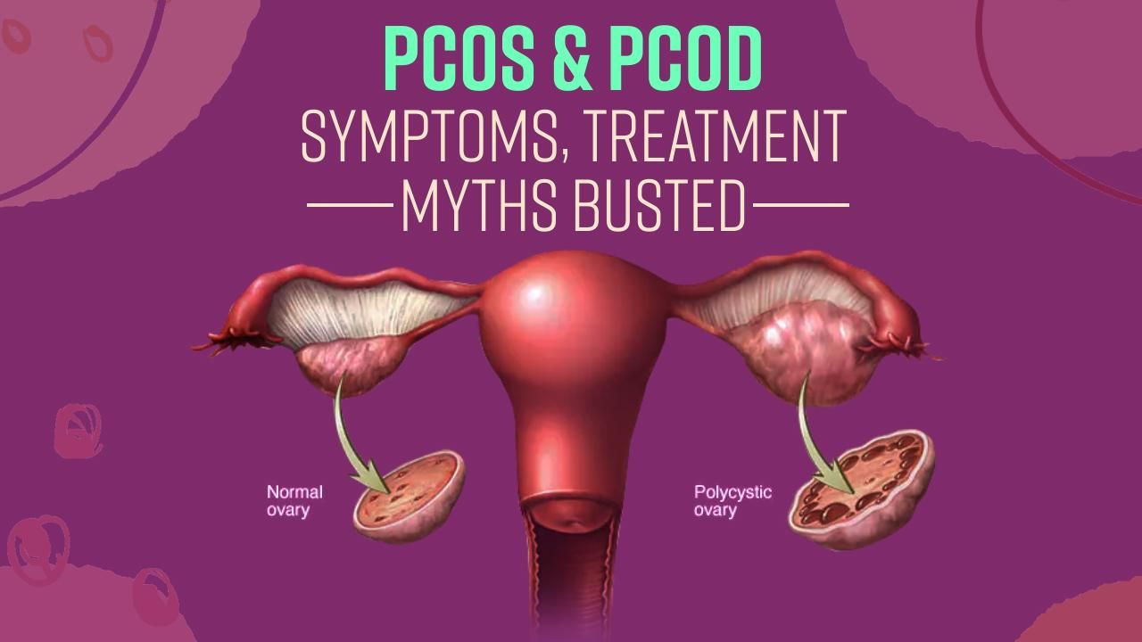 What Is PCOD And PCOS Symptoms Treatment Explained Watch Video