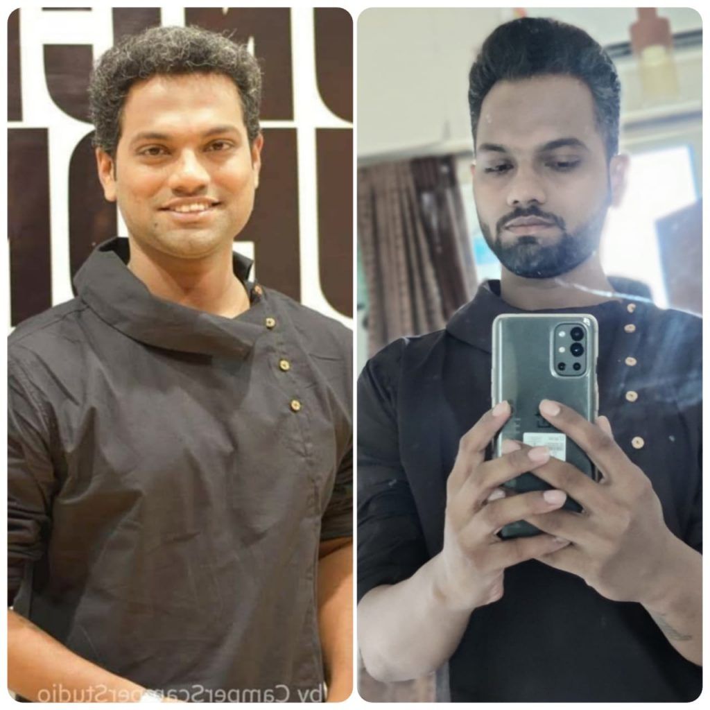 Real-Life Weight Loss Journey: I Lost 10 Kilos With Protein-Rich Diet And High-Intensity Workout Training