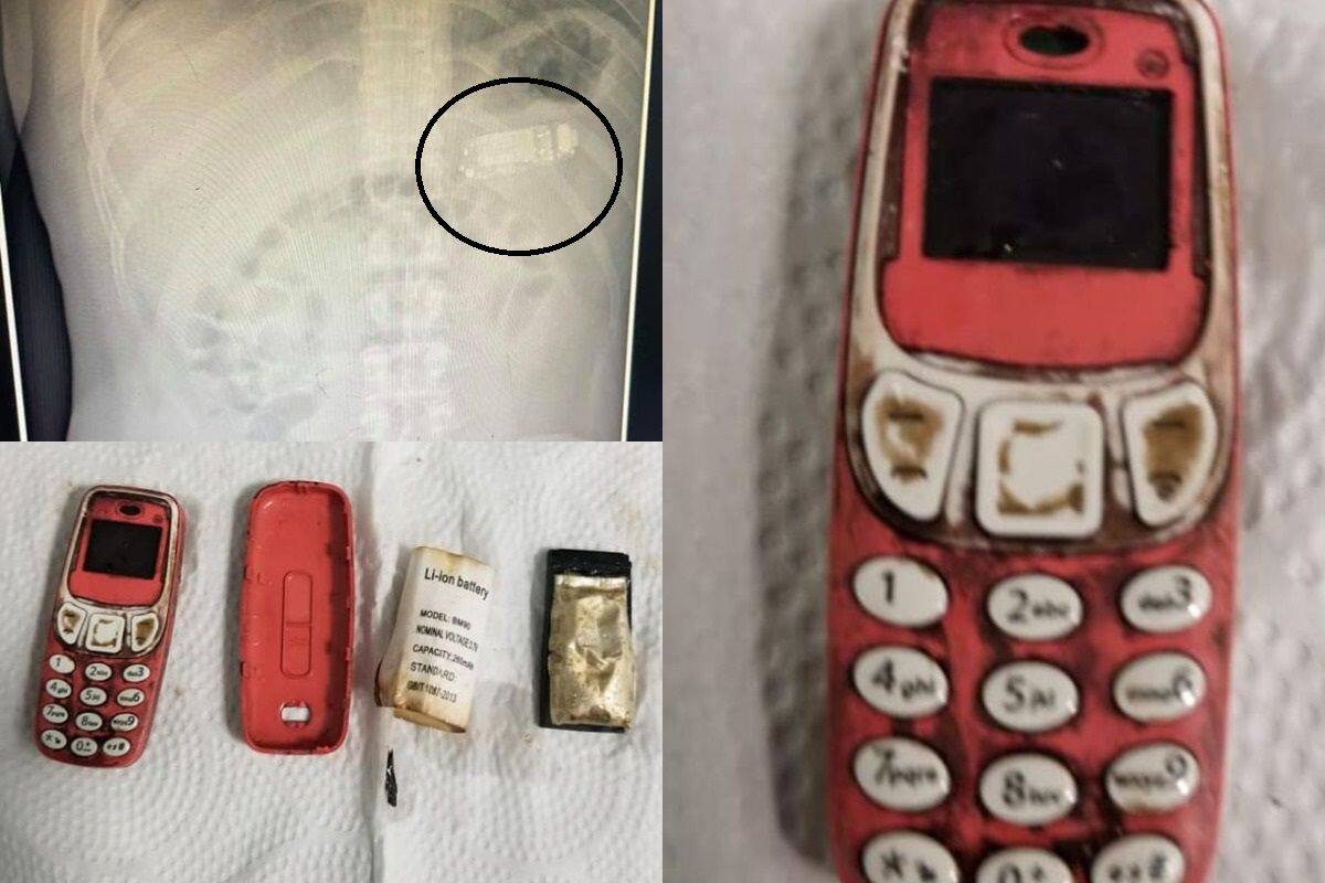 18 year-old dies when her aging Nokia smartphone explodes while