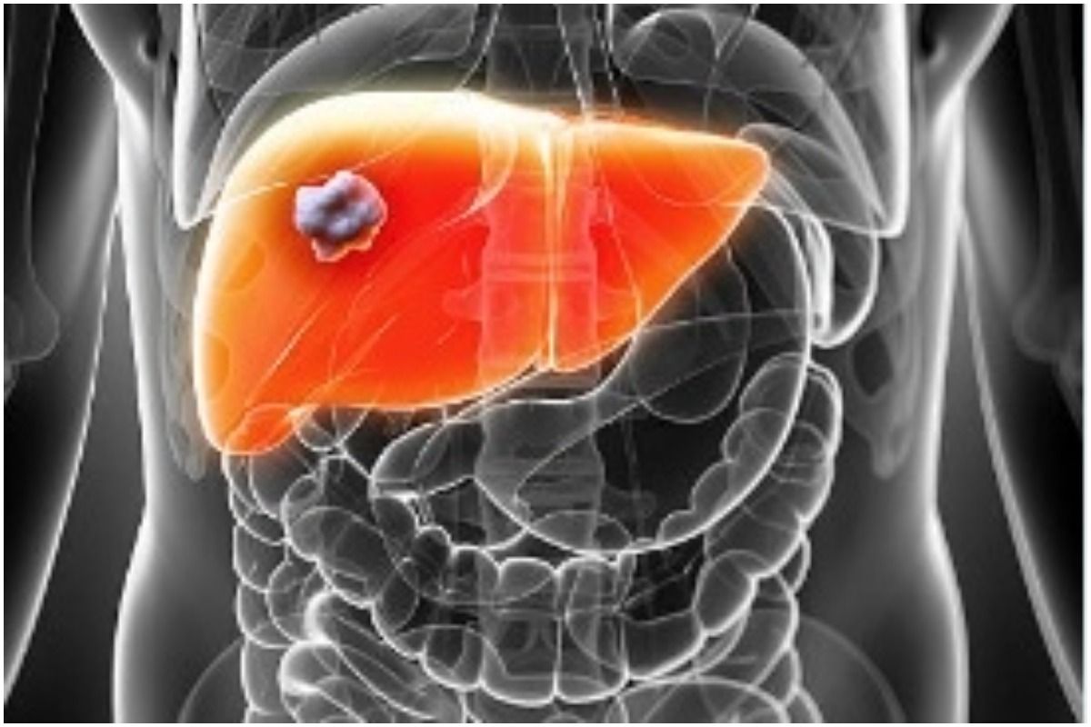 Can a Toxic Liver Affect Your Health? Here's What We Know