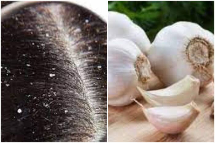 Garlic Hair Care Tips