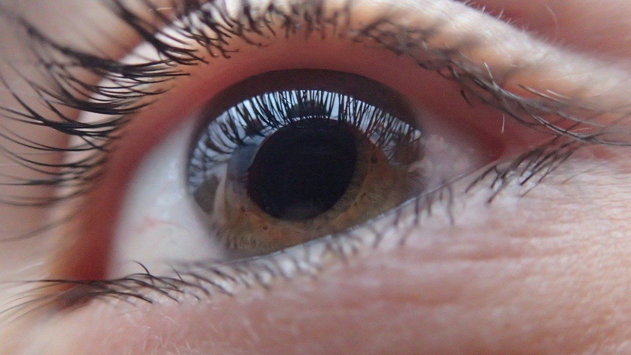 Glaucoma, A Leading Cause of Irreversible Blindness