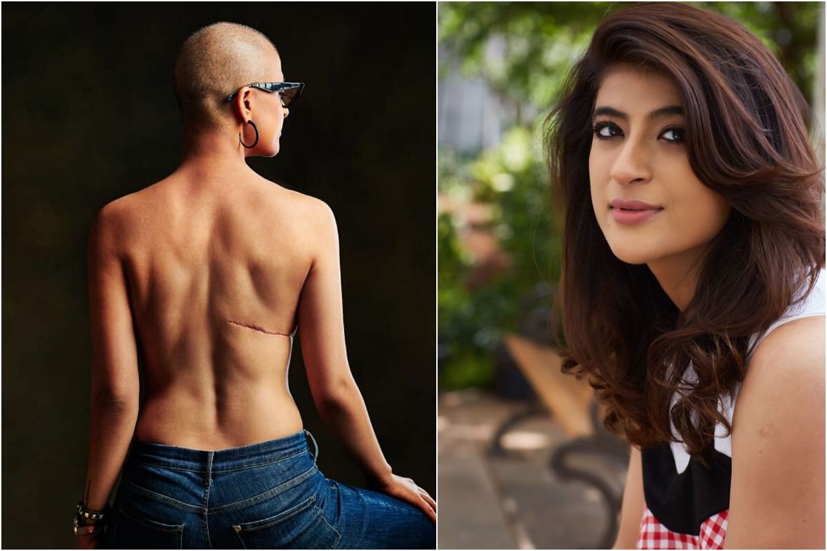 Shilpa Shetty Hot Boob Sex Video - From Lisa Ray to Manisha Koirala 9 Indian Actresses Who Battled Cancer With  a Tough Smile | Actresses who battled cancer