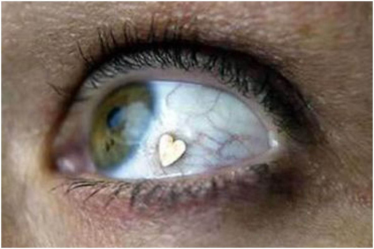 Eye Implant. Picture Credits: Pixabay