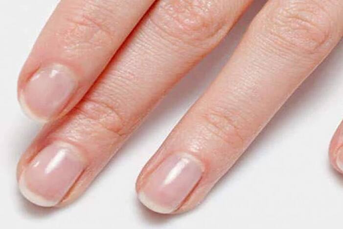 Omicron Symptoms: सावधान! तुमची त्वचा, ओठ आणि नखांमध्ये निळा रंग दिसल्यास दुर्लक्ष करू नका