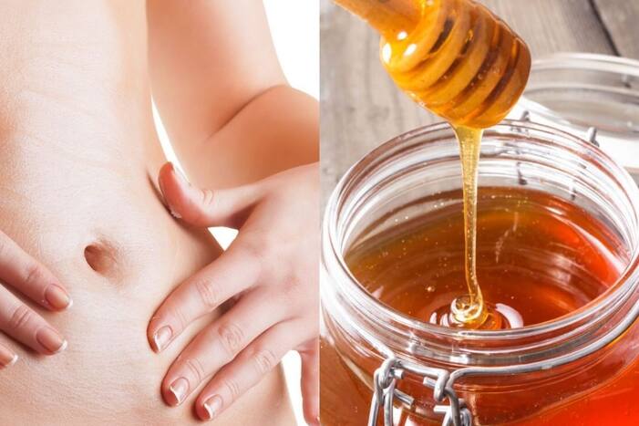 Putting Honey On Navel: नाभीवर रोज लावा मध, या सर्व समस्यांपासून मिळेल आराम