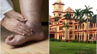 Scientists Find Cure For Diabetic Foot Ulcers