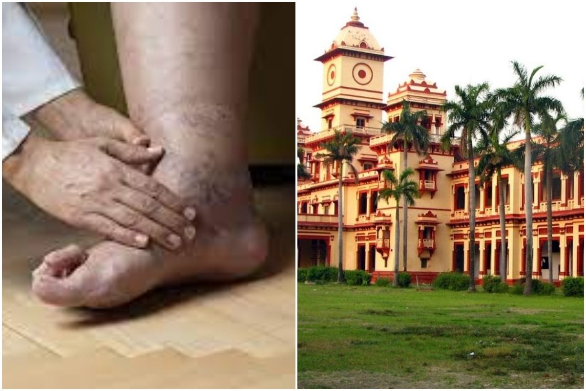 Scientists Find Cure For Diabetic Foot Ulcers