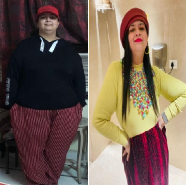 Real-Life Weight Loss Journey: This Software Engineer Lost 53 Kgs by Quitting Sugar, Rice