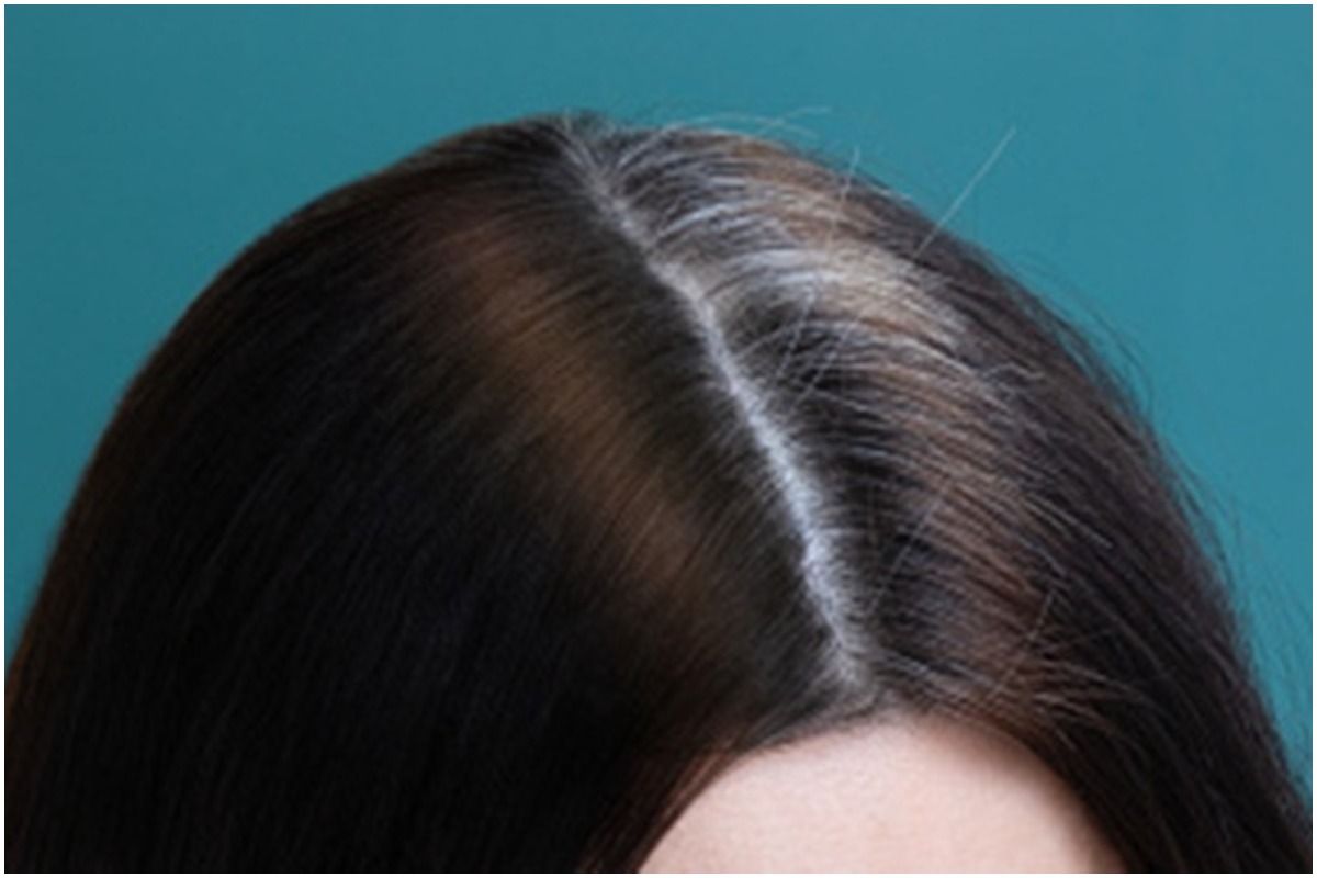 What Causes Grey Hair: 5 Ways to Reduce it - hair buddha