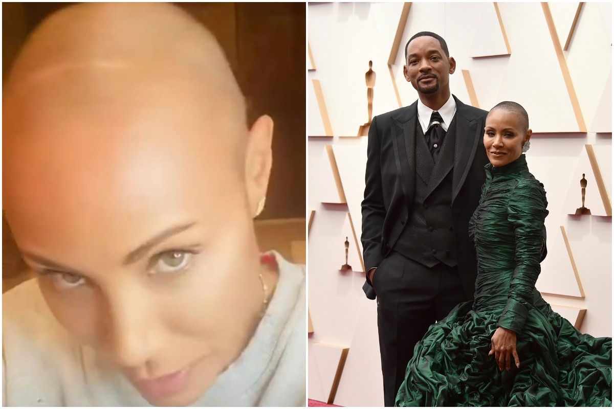 What is Alopecia? The Hair Condition That Will Smith's Wife Jada Pinkett is Suffering From. Picture Credits: Instagram (@jadapinkettsmith) & AP