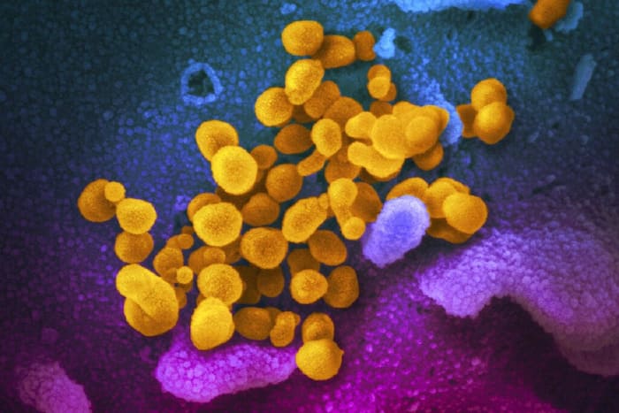 Delhi coronavirus 7