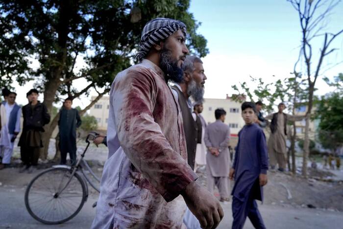 Suicide Bomber Kills 50 Worshippers At Kabul Mosque, Several Injured