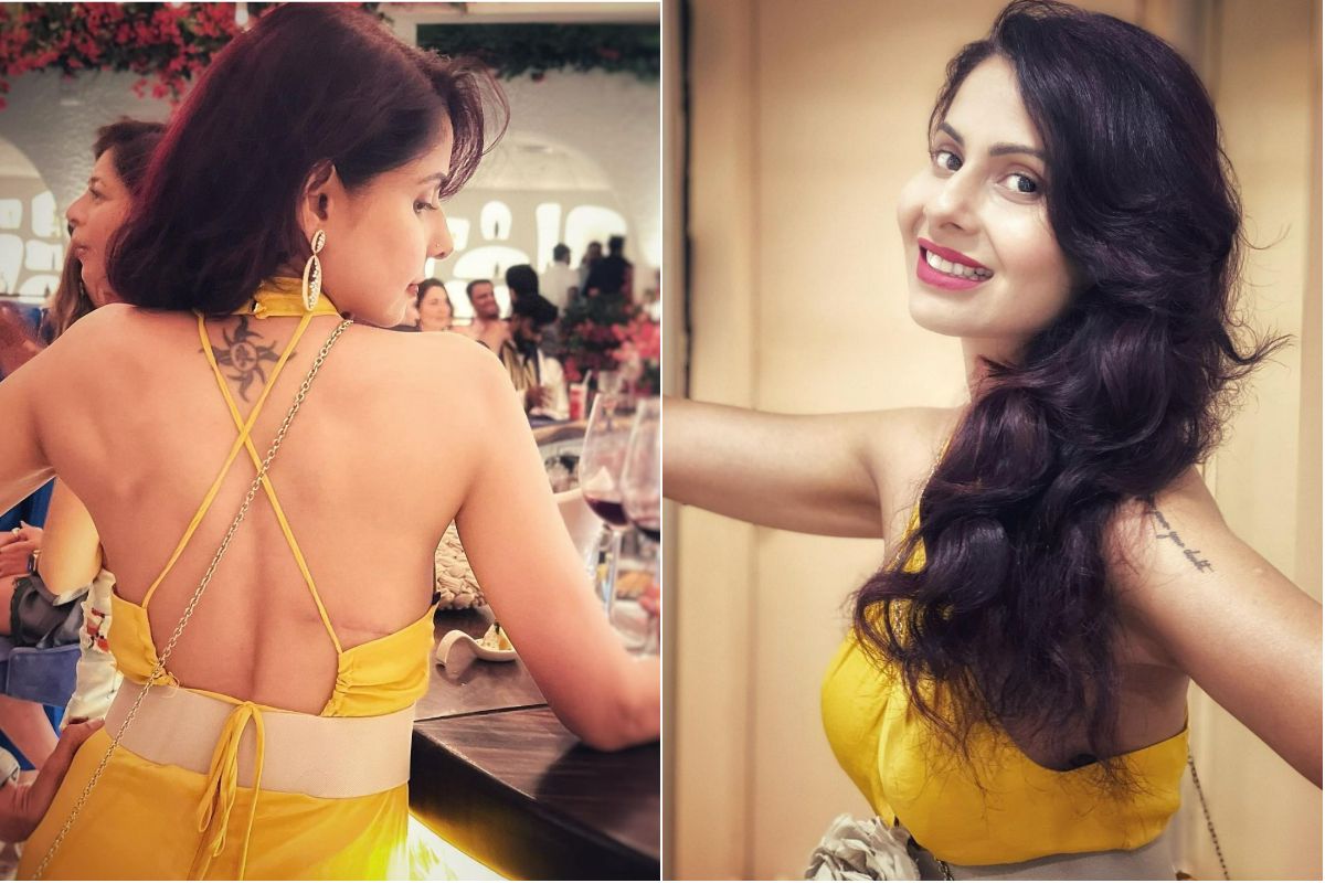 Chhavi Mittal Flaunts Scars From Breast Surgery Says People Ask Her To Remove It See Inspiring