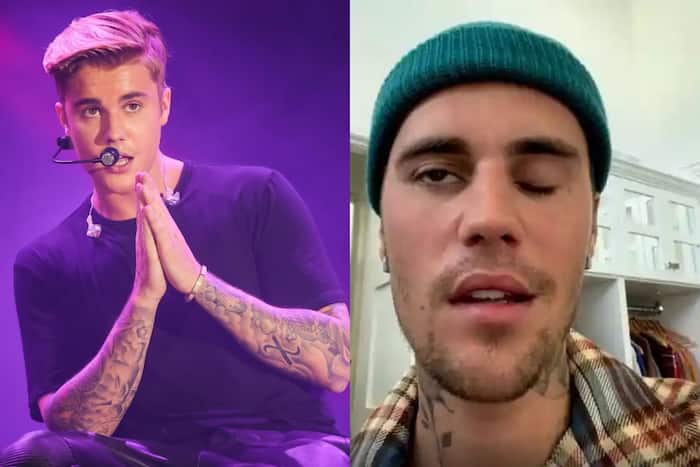 Justin Bieber Gets Facial Paralysis Because of Ramsay Hunt Syndrome ...