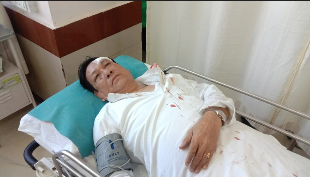 Tripura Pradesh Congress Committee (PCC) chief Birajit Sinha were injured in a clash between Congress and BJP supporters in front of Congress Bhavan in Agartala