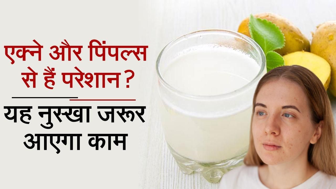 Skin Benefits Of Potato Juice आलू का रस है चेहरे के लिए वरदान, पिंपल्स