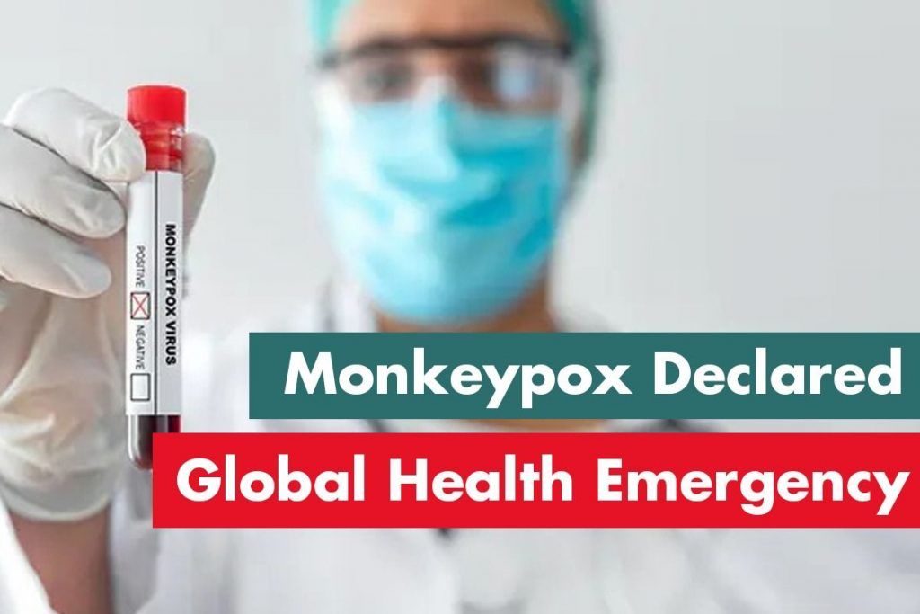 Monkeypox Cases on Rise Will it Invoke Lockdownlike Situation Your