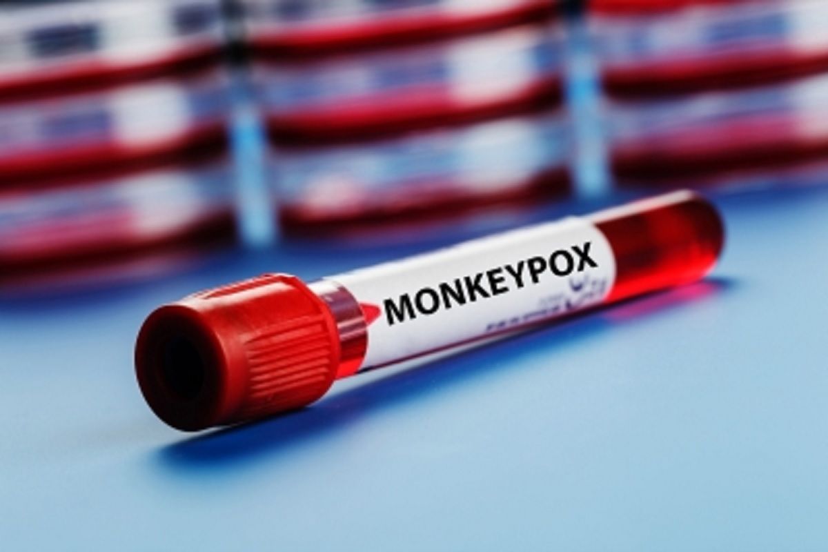 India has reported nine cases of monkeypox; five from Kerala and four, including a 31-year-old woman from Nigeria who tested positive on Wednesday, from Delhi.