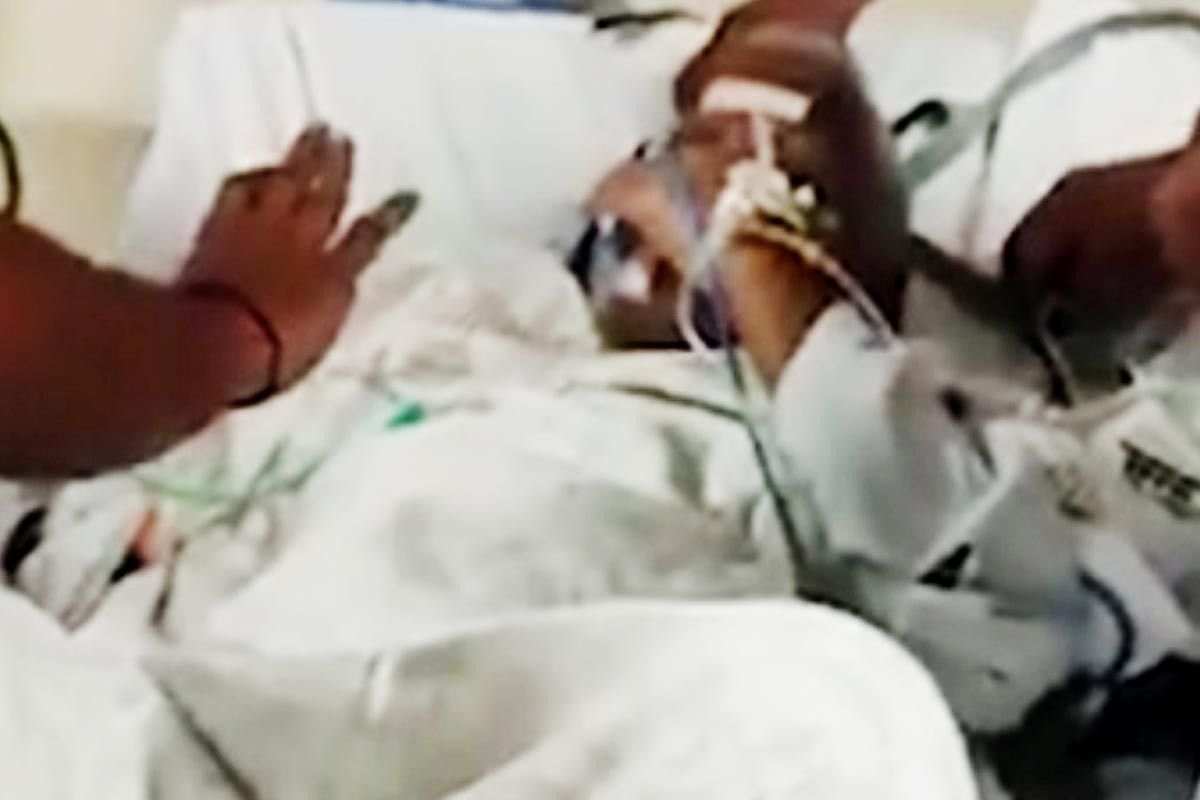 Lalu Yadav Health Update: Doc Monitoring All Vital Organs After Fracture