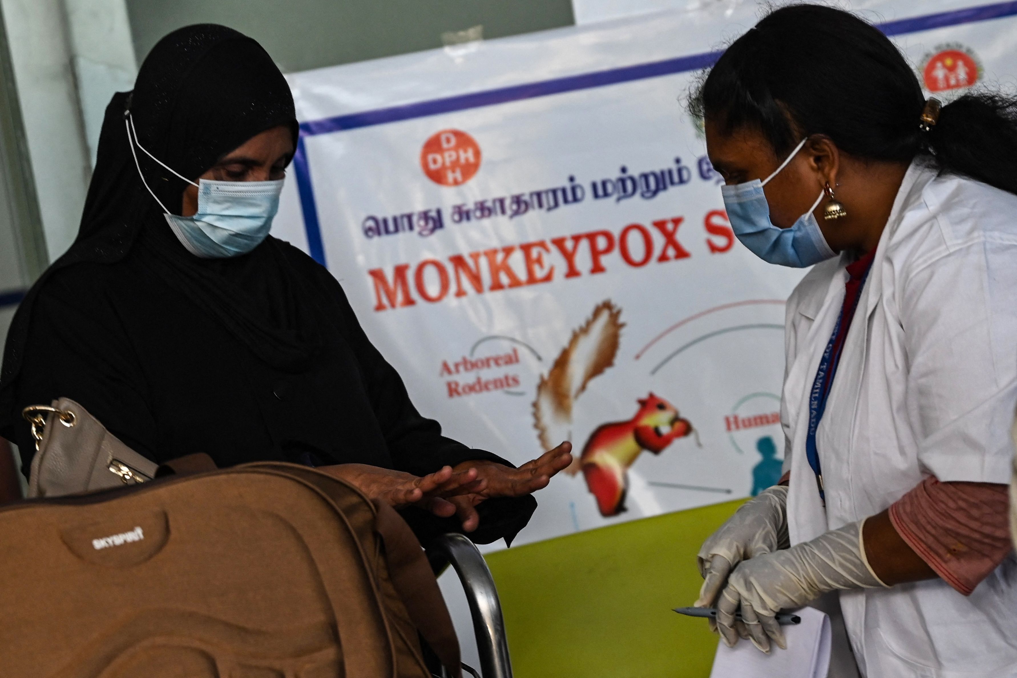 Monkeypox Outbreak: Dos and Don’ts to Avoid Contracting the Viral Disease