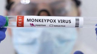 Monkeypox Creates Havoc in US: Who Are At Risk, Where Could It Spread Next l EXPLAINED