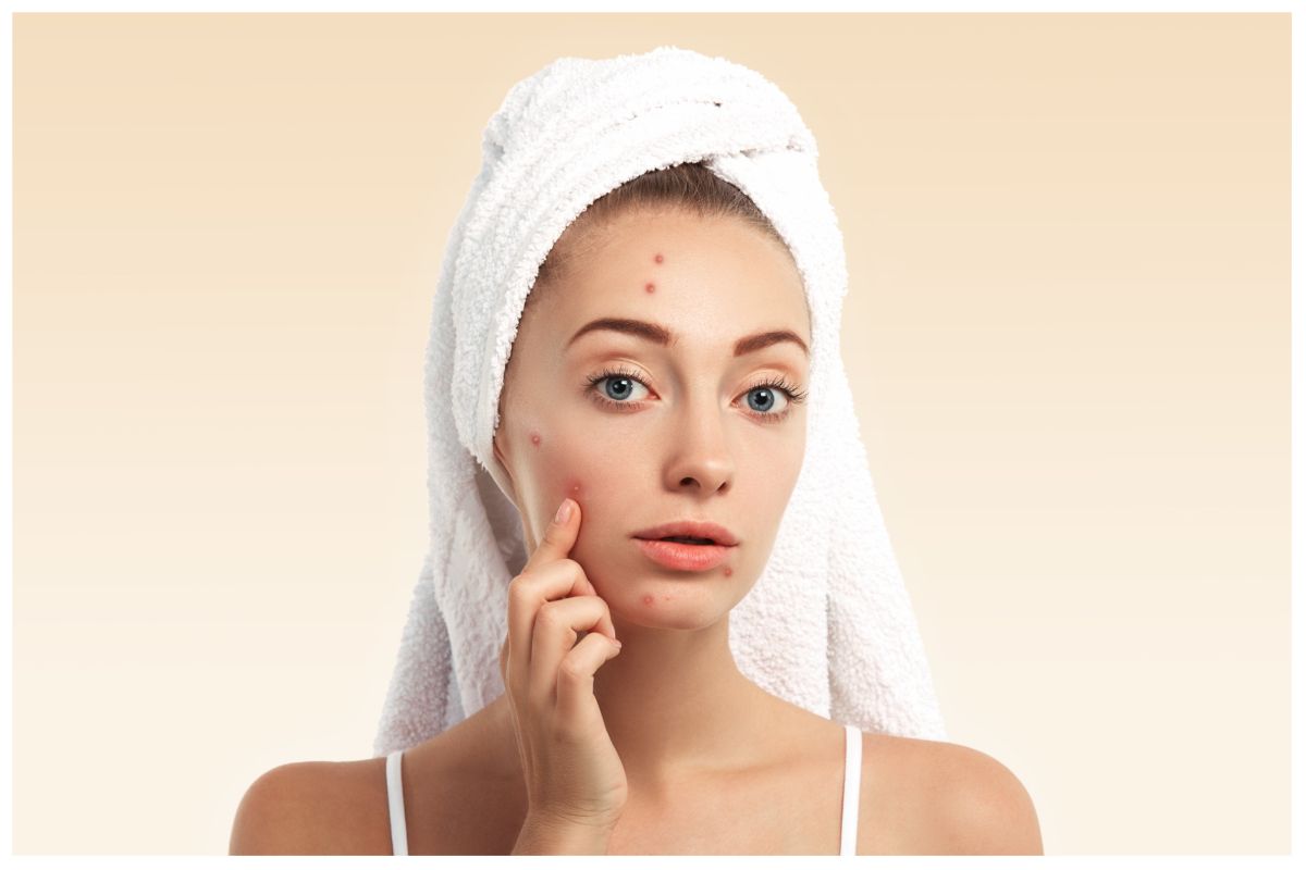 Protect Your Skin From Humidity With These Skincare Tips