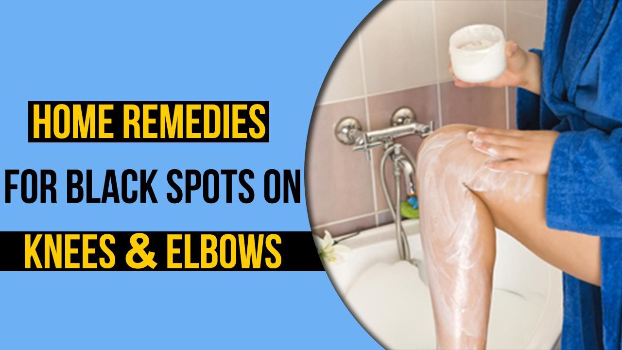 Body care Tips Easy And Effective Home Remedies To Get Rid Of Dark Elbows And Knees Watch Video