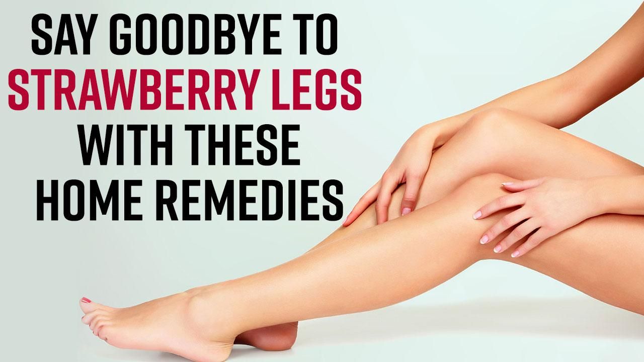 Strawberry Legs Home Remedies Easy And Effective Natural Ways To Get Rid Of Strawberry Legs Watch Video