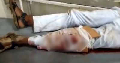 viral-video-cardboard-used-as-makeshift-plaster-on-patient-s-fractured-leg-at-mp-s-bhind-hospital-or-watch