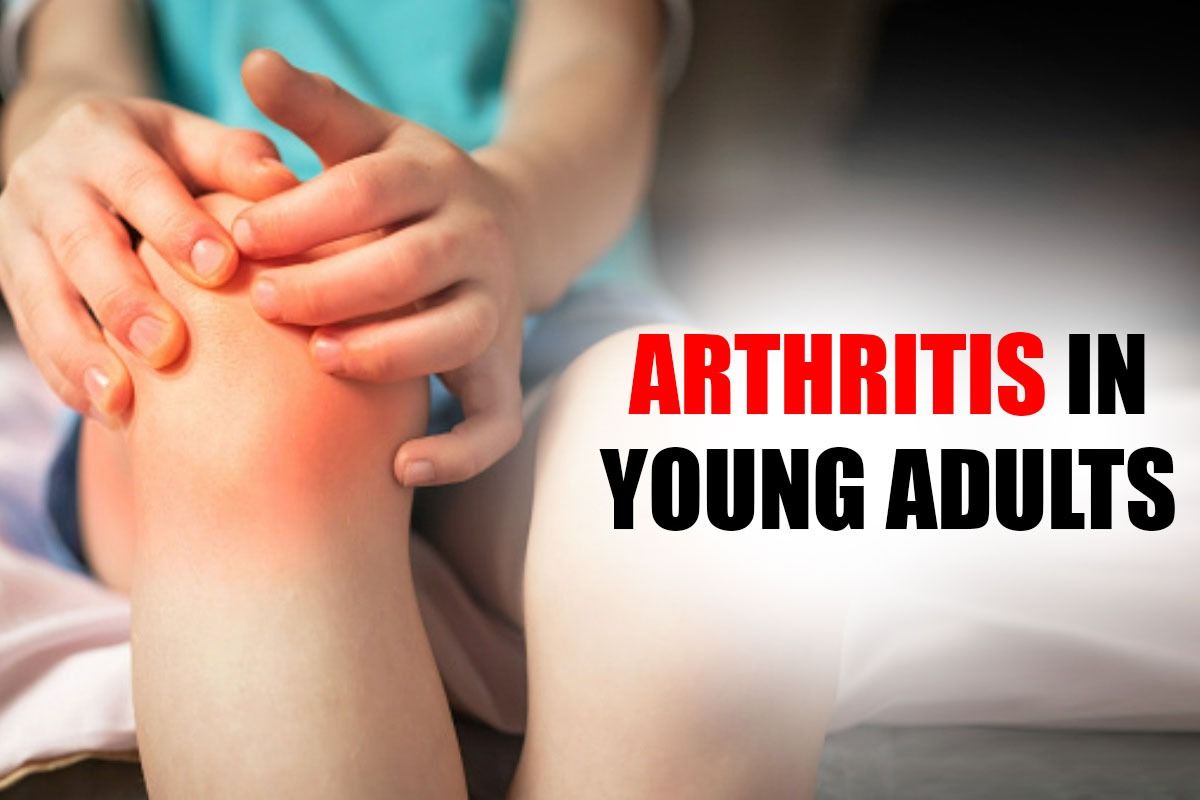 Home Remedies For Arthritis in Young Adults