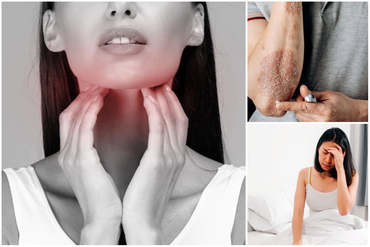 क्या आपके शरीर में आयोडीन की कमी हो गई है? इन लक्षणों से पहचानें