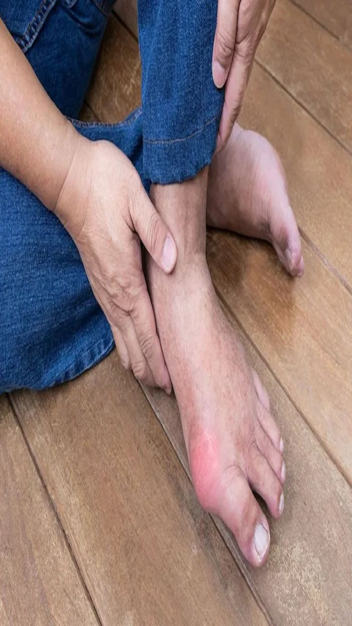 Papaya Benefits तुम्हालाही आहे का यूरिक अ‍ॅसिडची समस्या? भरपूर पपई खा