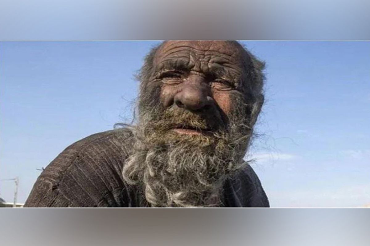 मर गया दुनिया का सबसे गंदा आदमी, 50 साल से नहाया नहीं, सड़ा मांस-स्मोकिंग  की ऐसी लत...देखें तस्वीरें