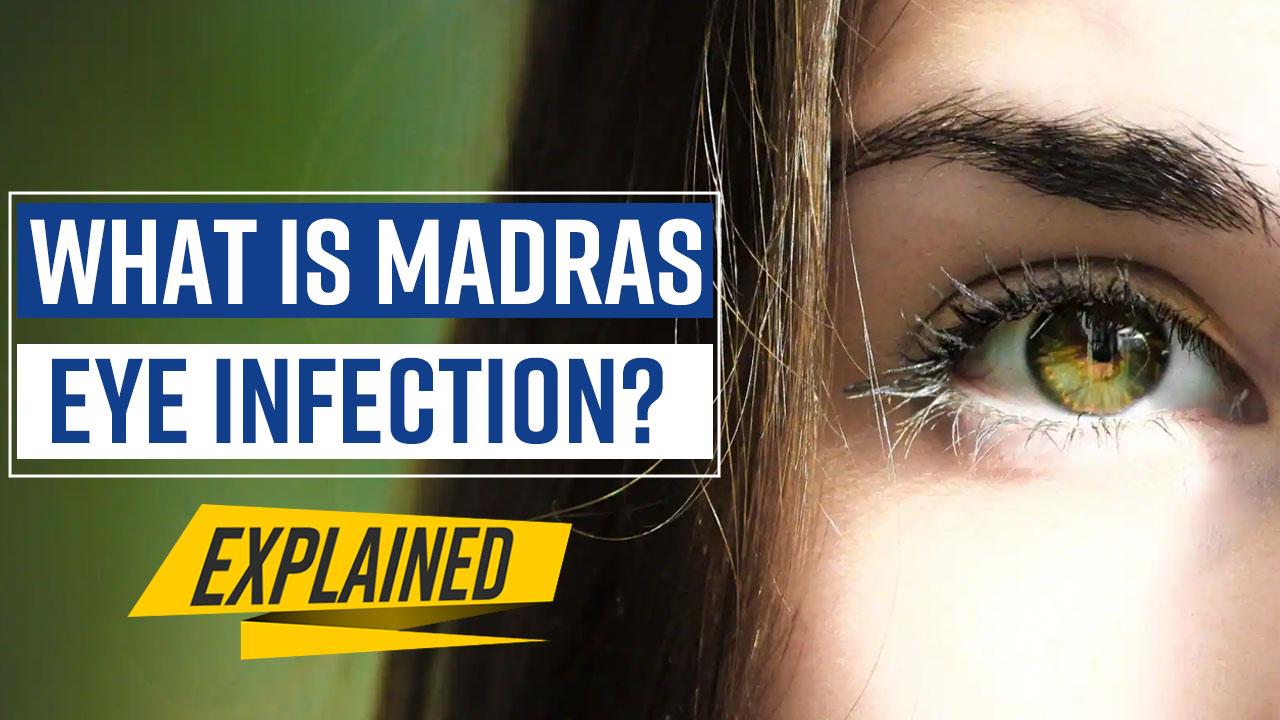 Madras Eye Cases Rise In Tamil Nadu Here Is What The Infection Is Its Causes Symptoms And 5867