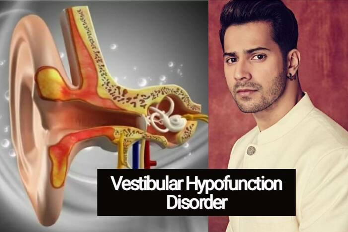 varun dhawan suffers Vestibular hypofunction