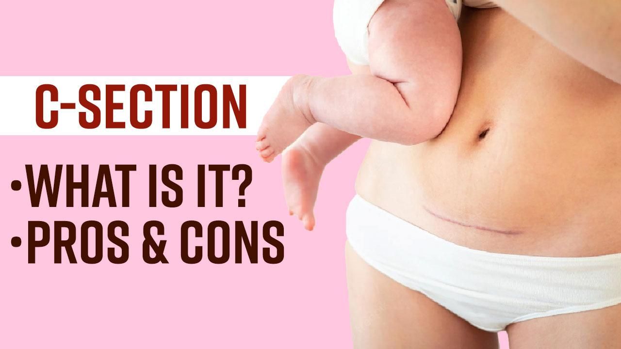 the-lasting-effects-of-c-section-complications-on-your-child-s-health