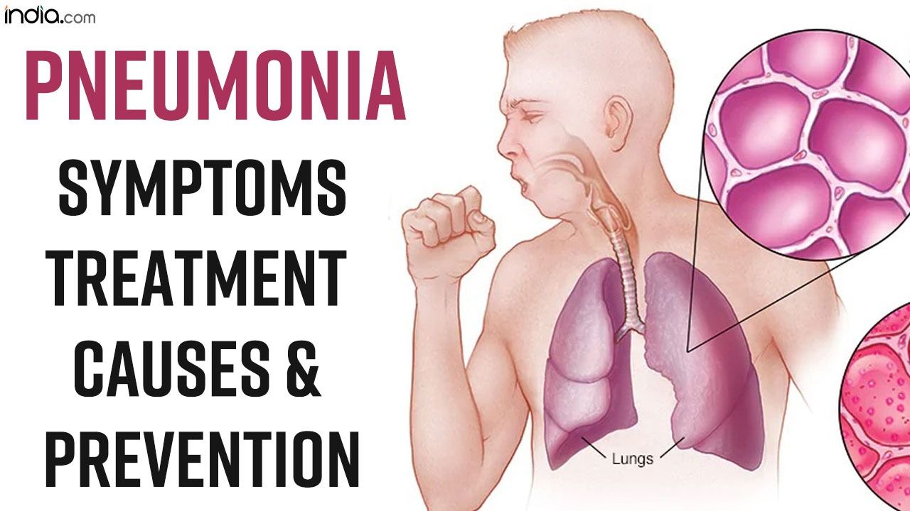 World Pneumonia Day 2022 What Causes Pneumonia Symptoms And Prevention Explained Watch Video