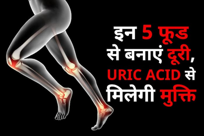 Uric Acid Remedy For Winter सर्दियों में इन 5 चीजों से रहें दूर जोड़ों में जमा यूरिक एसिड अपने