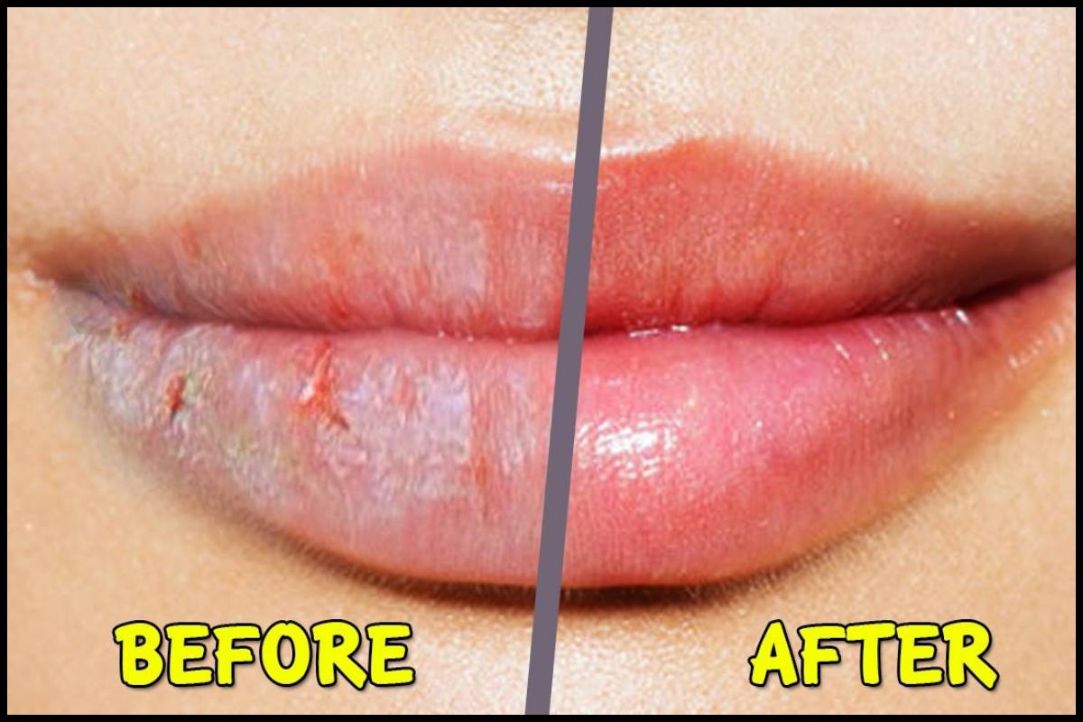 कर लिया ये काम तो पूरी सर्दी नहीं फटेंगे होंठ, घर पर ही मिल जाएगा सारा