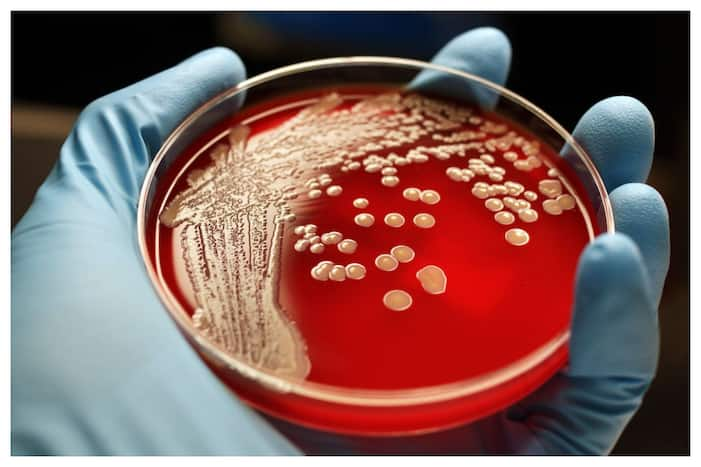 Latest Antibiotics, Bacterial Infection, WHO Report, WHO, anti-microbial resistance, antibiotics, Global Antimicrobial Resistance and Use Surveillance System Report 2022, GLASS REPORT, bacteria, Klebsiella Pneumoniae, Acinetobacter spp, infection, blood, Carbapenem group of drugs, imipenem, meropenem, ertapenem, doripenem, Neisseria gonorrhea, STD, sexually transmitted disease, E coli bacteria, MRSA, Antibiotic resistance, Lancet