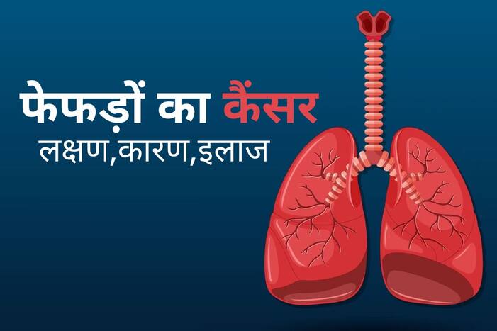 फेफड़ों का कैंसर
