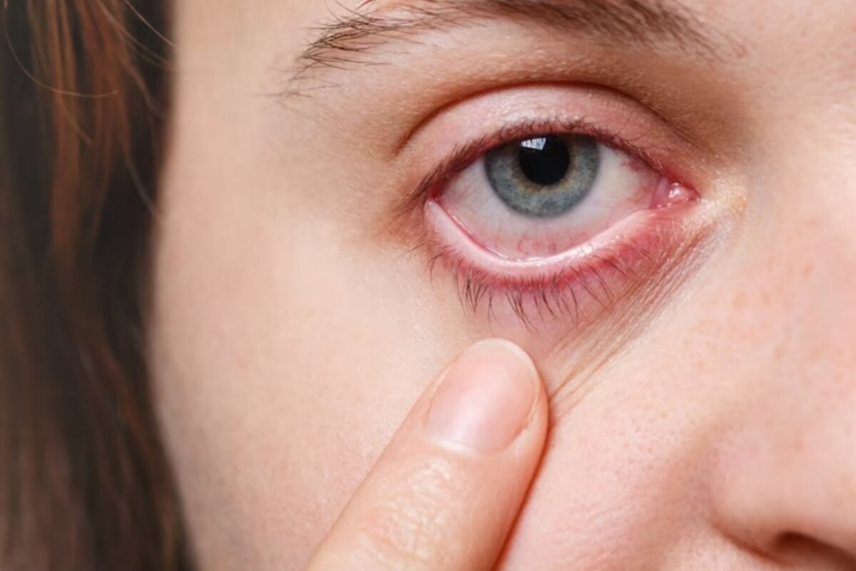 Glaukom: Warnzeichen, Symptome, Ursachen und Behandlung