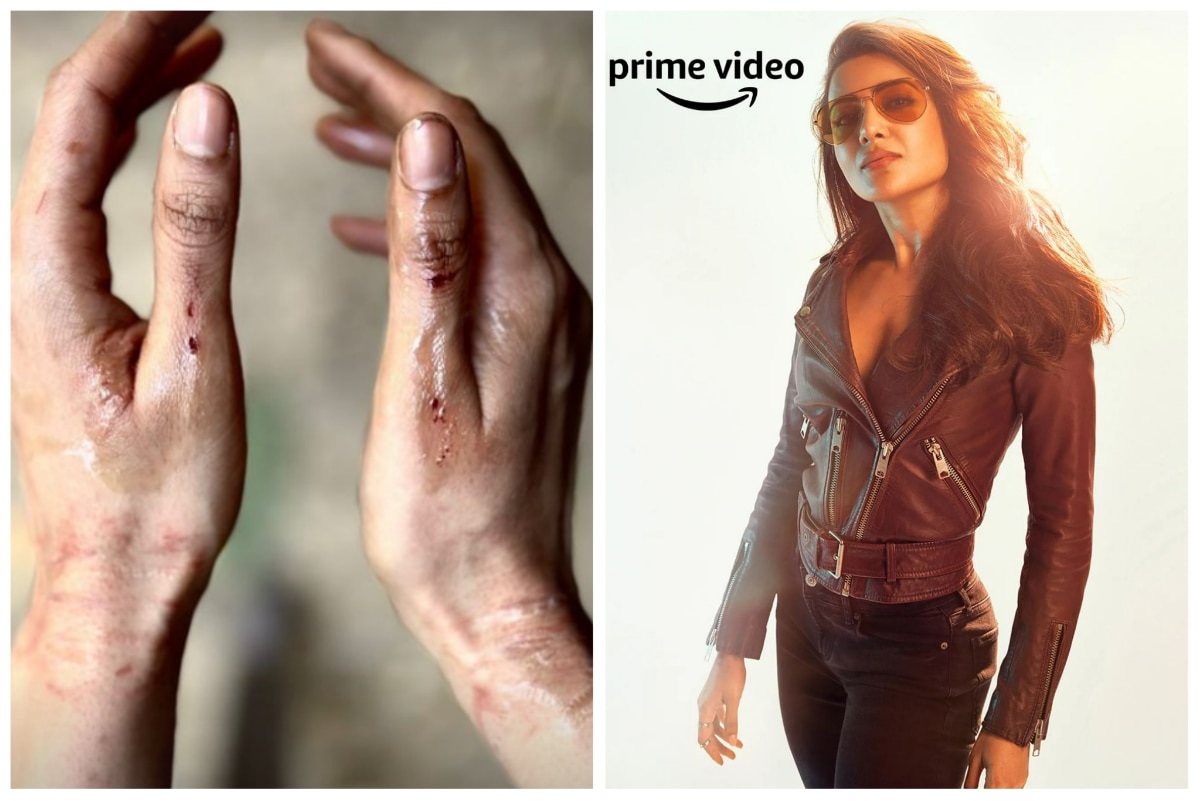 Samantha Ruth Prabhu Gets Injured While Shooting For Indian Adaptation of American Sci-Fi Series Citadel