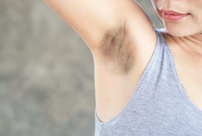 How to treat dark underarms