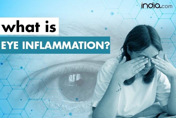 Read more about the article Symptoms, Causes And Treatment of Uveitis