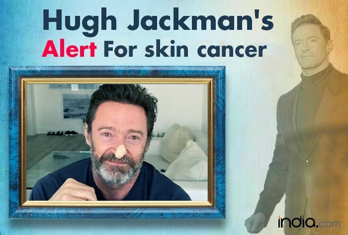 Hugh Jackman Screens For Basal Cell Carcinoma, Skin Cancer Know Signs ...